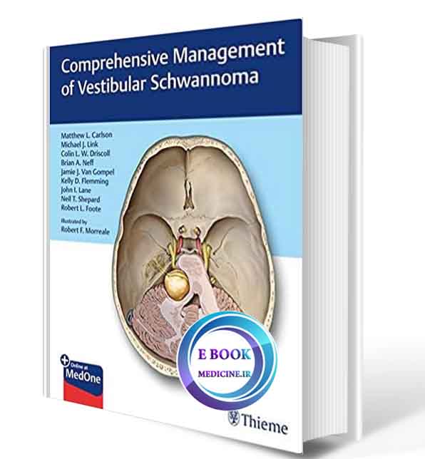 دانلود کتابComprehensive Management of Vestibular Schwannoma 2019(ORIGINAL PDF)